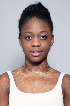 Picture of Michaela DePrince