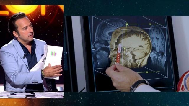 La investigación sobre cómo varía y qué ocurre en el cerebro de un corrupto.