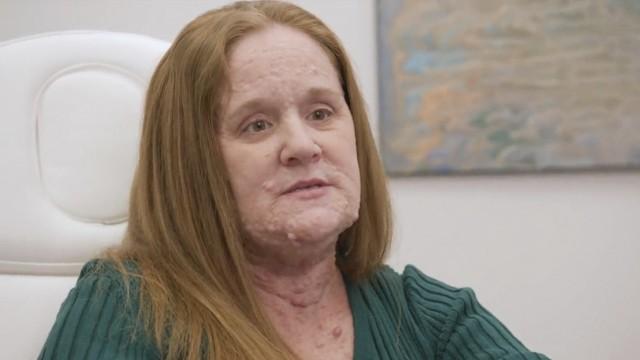 Tumors, Tumors, Everywhere